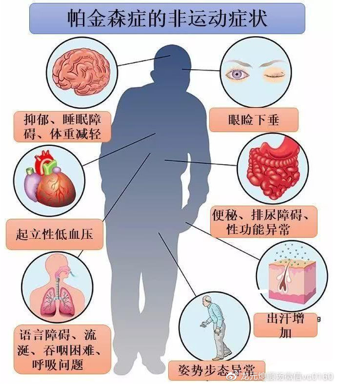 帕金森病最新治疗方法及其论述